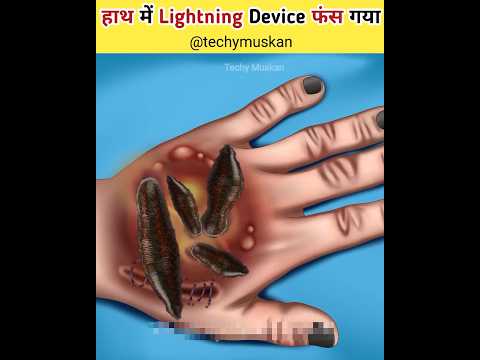 हाथ में Lightning Device फंस गया 😲 #asmr #viral