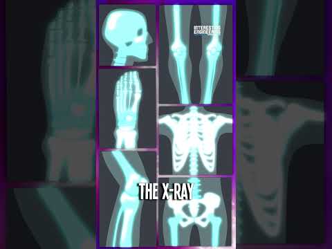 Superior X-Ray Generation with Electron Waveshaping
