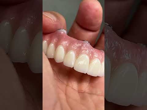 Great All-On-4 Zirconia